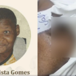 Mulher que morreu após ser infestada por larvas em hospital de BH será velada nesta terça