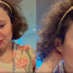 Maiara, da dupla com Maraisa, relata queda de cabelo após diagnóstico de alopecia