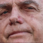 Bolsonaro apresenta piora da função renal, diz novo boletim médico