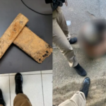 Homem que agrediu mulher a pauladas em BH pode responder por tentativa de feminicídio