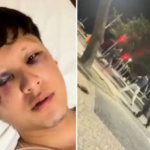 Mexicano agredido com garrafada no Rio dá forte relato e agradece atendimento: ‘Tamo junto’