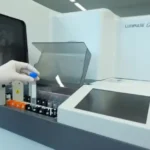 Exame de sangue para Alzheimer chega ao Brasil; veja preço e quem pode fazer