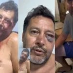 Assessor parlamentar denuncia sessão de espancamento durante ação da PM em Sabará