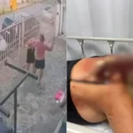 ‘Tenho certeza que ele vai me matar se for solto’, diz mulher agredida com barra de ferro pelo marido em BH